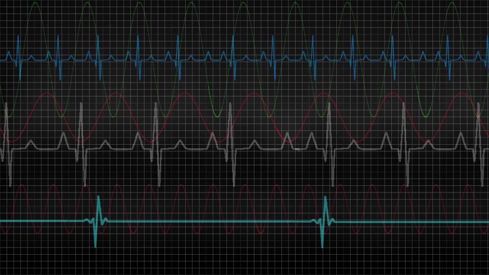 Other Analog I/O Modules